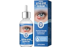 ATAZUA Stye Eye Treatment, Stye Eye Serum for Styes Chalazion and Blepharitis, Gently Cleanses Lashes and Eyes, Restore Healthier Eye Skin, 1 Fl.oz