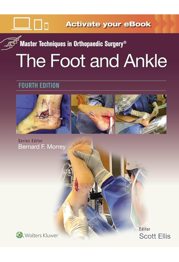 Coughlin and Mann's Surgery of the Foot and Ankle, 2-Volume Set