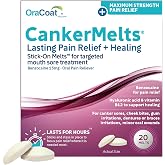Oracoat CankerMelts Stick-On Melts for Canker/Mouth, 15mg Benzocaine, 20ct | Stick the canker sore treatment inside mouth near sore, 15mg benzocaine, hyaluronic acid &amp; vitamin E for canker sore relief