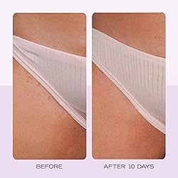 First Aid Beauty - Ingrown Hair Pads with BHA + AHA