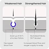 Sons Men's Hair Loss Treatment Minoxidil 5% Biotin DHT Shampoo 1 Month view 8
