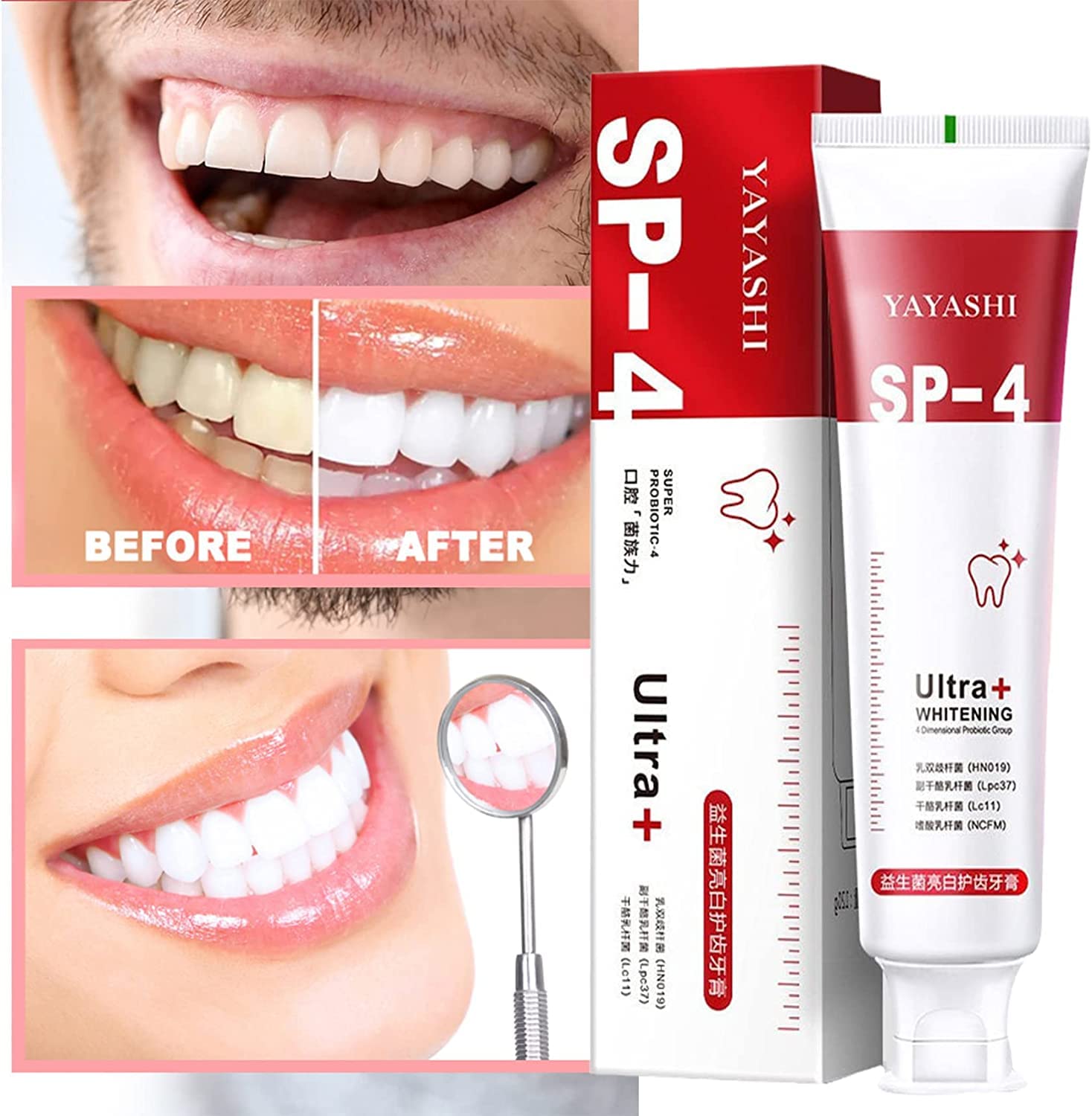 Sp-4 Probiotic Whitening Toothpaste, Ultra Whitening Toothpaste, Sp-4 Ultra Whitening (Red)
