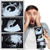 Farm and Posh Personalized Pregnancy Prank Ultrasound Photos | Customized Ultrasound Positive Test Results Strip of 3 Photos from Real Ultrasound Printer | Hilarious Gag Gift