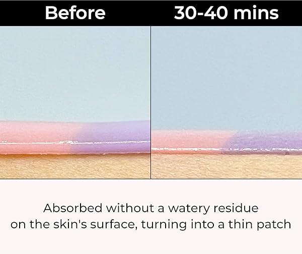 MISOLI DREAM GLOW UNDER EYE PATCHES | ANTI-AGING EYE TREATMENT GEL MASKS WITH VEGAN COLLAGEN & BAKUCHIOL | UNDER EYE MASKS FOR DARK CIRCLES AND PUFFINESS, UNDER EYE BAGS, WRINKLE CARE, MEN AND WOMEN