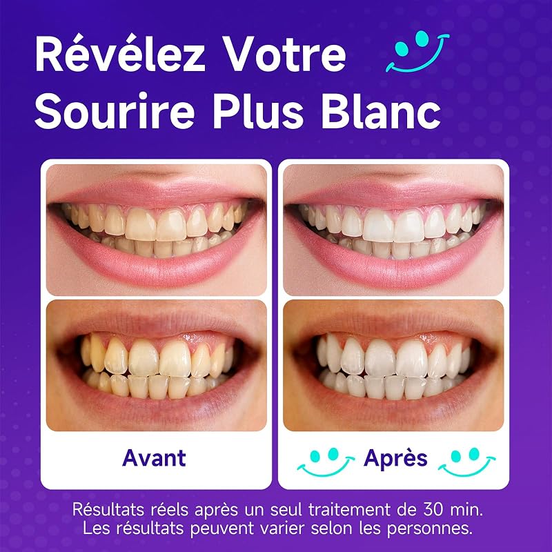 Bande Blanchiment Dentaire Violet, Bandes Blanchissantes pour Dents: 14 Bandes Violettes 7 Paires, Résultat Rapide, Élimine Taches Café/Thé/Vin/Cigarette, Idéal avant un Événement, Sûr pour l'Émail — photo 4 sur 8