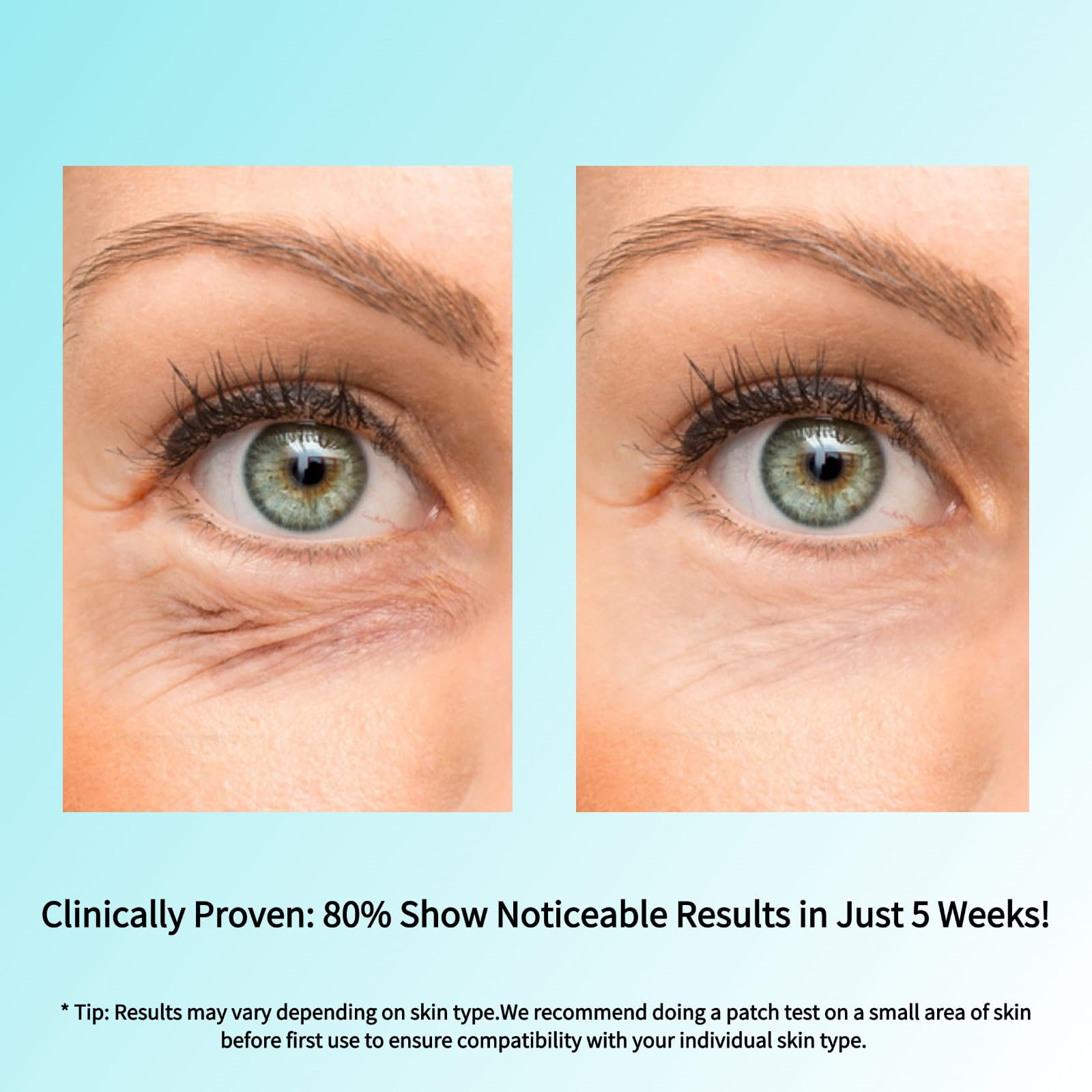 SEACALL Retinol Eye Cream with Caffeine, Hyaluronic Acid & Vitamin C | Anti-Aging Under Eye Cream for Dark Circles, Wrinkles & Puffiness | Reduces Fine Lines Skin Care Treatment for Women & Men (15ml)