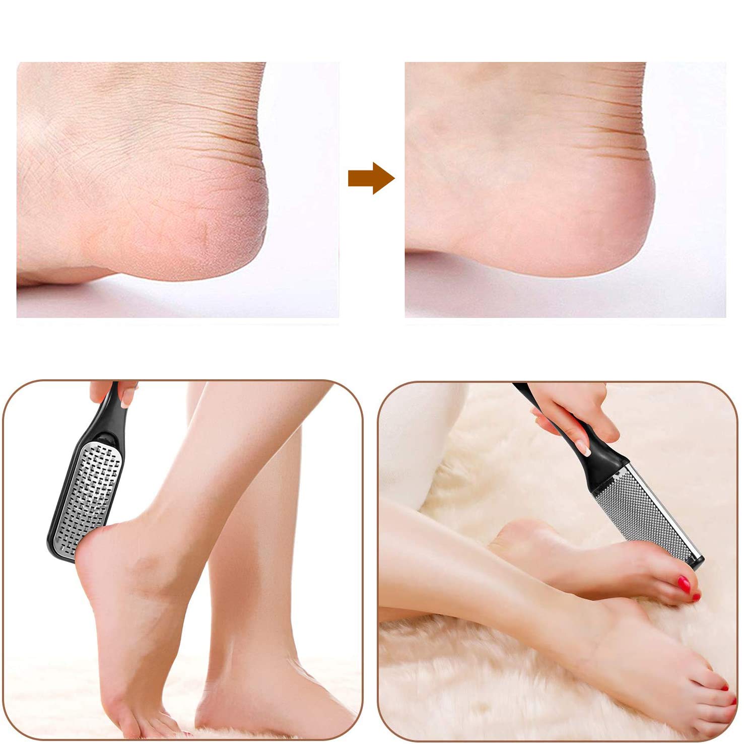 Pedicure Kit Professional 15 in 1, AOMEES Pedicure Set Stainless Steel Foot Rasp Foot Peel and Callus Clean Feet Dead Skin Tool Set, Callus Remover with Nail Toenail for Home&Salon Care Tools Set : Beauty