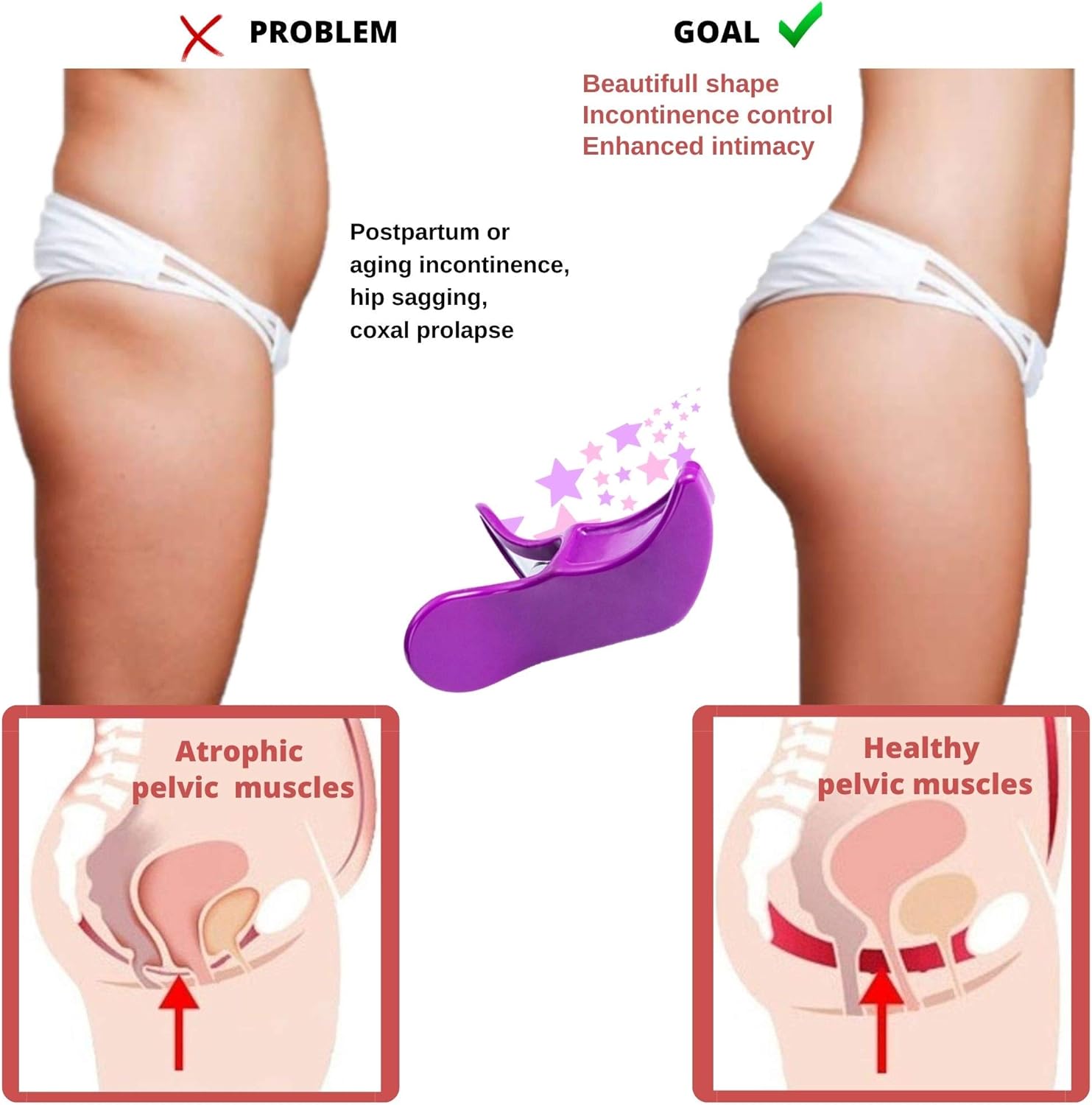 BaradzeYFerm Hip Trainer Buttocks Lifting - Pelvic Floor Muscle Exerciser - Inner Thigh Exercise Equipment - Hipsline Body Sculpt Tool - Fitness Bladder Control Exerciser - Postpartum Recovery: Sports & Outdoors