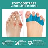 Welnove 8 Pack Toe Separators Bunion Corrector for Women Men Blue view 3