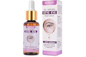 ACYEAH Stye Eye Treatment, Chalazion Remover for Eye Stye, Stye Eye Serum for Irritation, Dry Eyes, Styes and Blepharitis, Fast Relief, 30ML (1.01 oz)