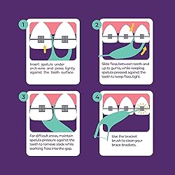 Platypus Orthodontic Flossers for Braces, 30 Count