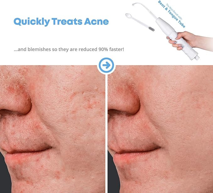 pure daily care nuderma