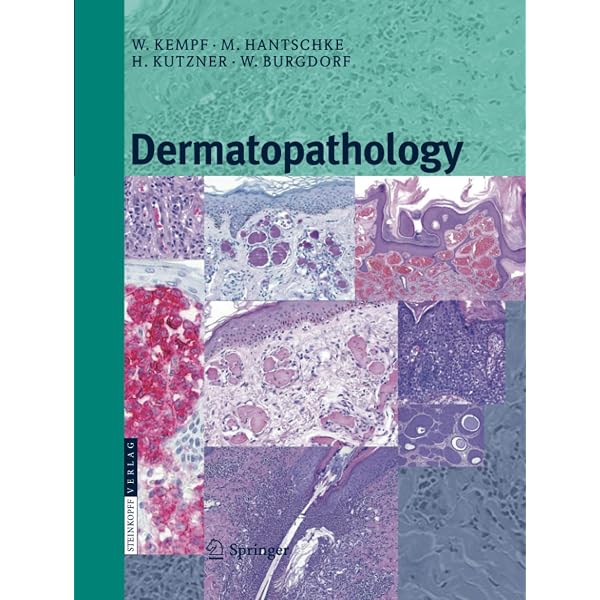 Histopathology of the skin: Walter F. Lever: 9780397520954: Amazon