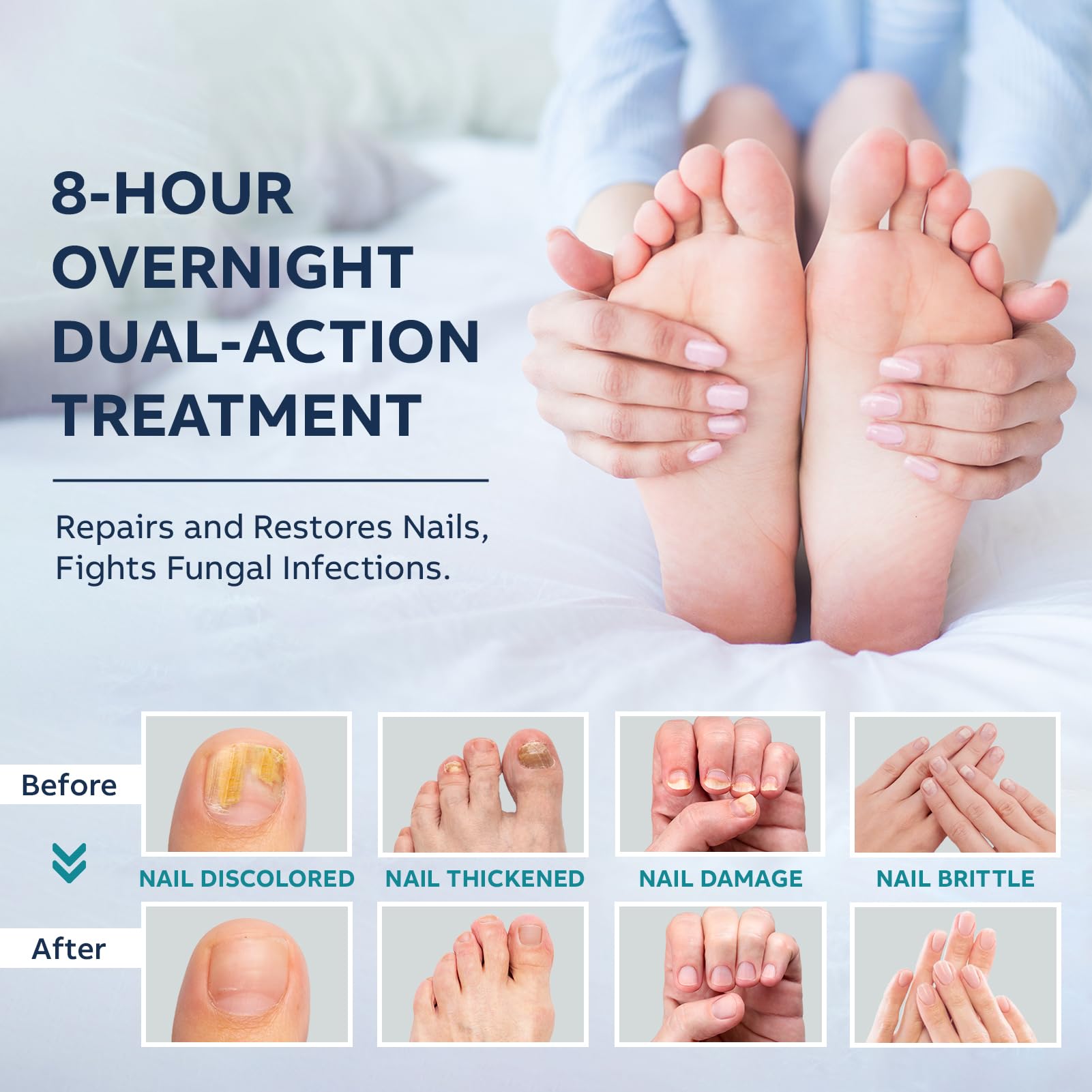 Toenail Fungus Treatment Extra Strength Kit: Nail Repair Liquid Solution and Patches - Nighttime Nail Patches Renewal - Fast Acting Drops with Undecylenic Acid, Natural Oil for Toe Finger Nails - Image 3