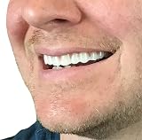 Instant Smile Comfort Fit Flex Cosmetic Upper Teeth Bright White Veneer view 3