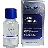 Oil-Free Local Acne Essence, Acne Drying Lotion, Acne Treatment For Face, Acne Spot Serum Night Use to Target Acne and Unclog Facial Pores