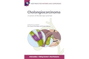 Fast Facts for Patients and Supporters: Cholangiocarcinoma: A Cancer of the Bile Duct and Liver