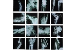 16Pcs Realistic Broken Bones X-Ray (9.8"x9.8") Skeleton X-Rays Human Skeleton Broken Bones PVC Plastic X-Ray Pretend Play Doc