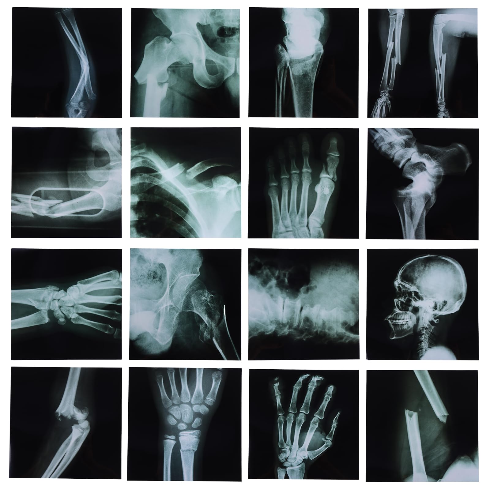 Photo 1 of 16 Pcs Broken Bones X-Ray Set, Black and White Skeleton Pretend X-Rays, 9.84" x 9.84"