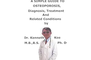 A Simple Guide To Osteoporosis, Diagnosis, Treatment And Related Conditions
