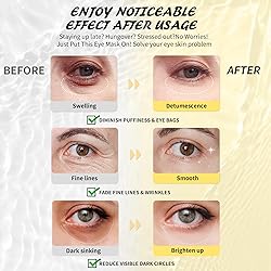 Maskiss Under Eye Patches(8 Pairs), 24K