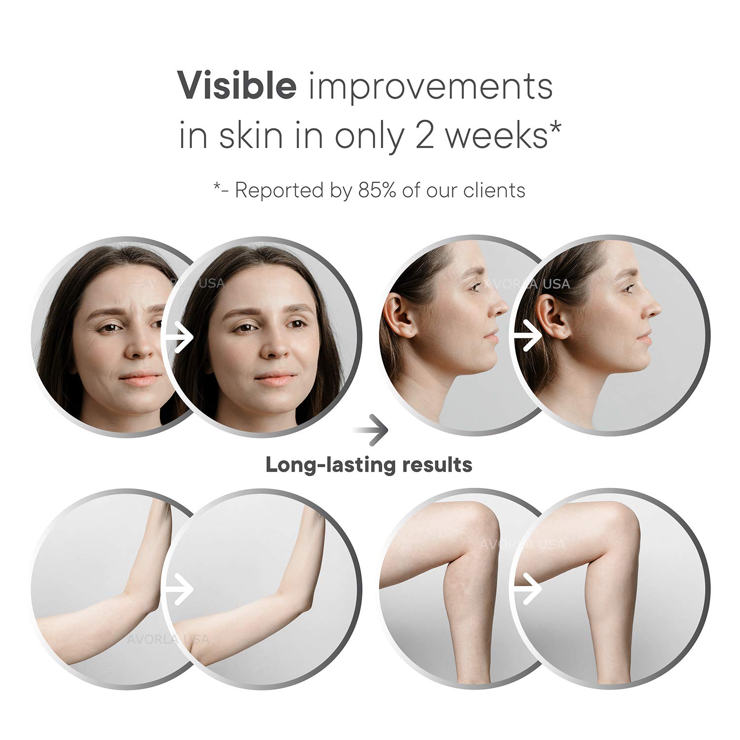 Avorla High Frequency Skin Tightening Machine, Black: Beauty