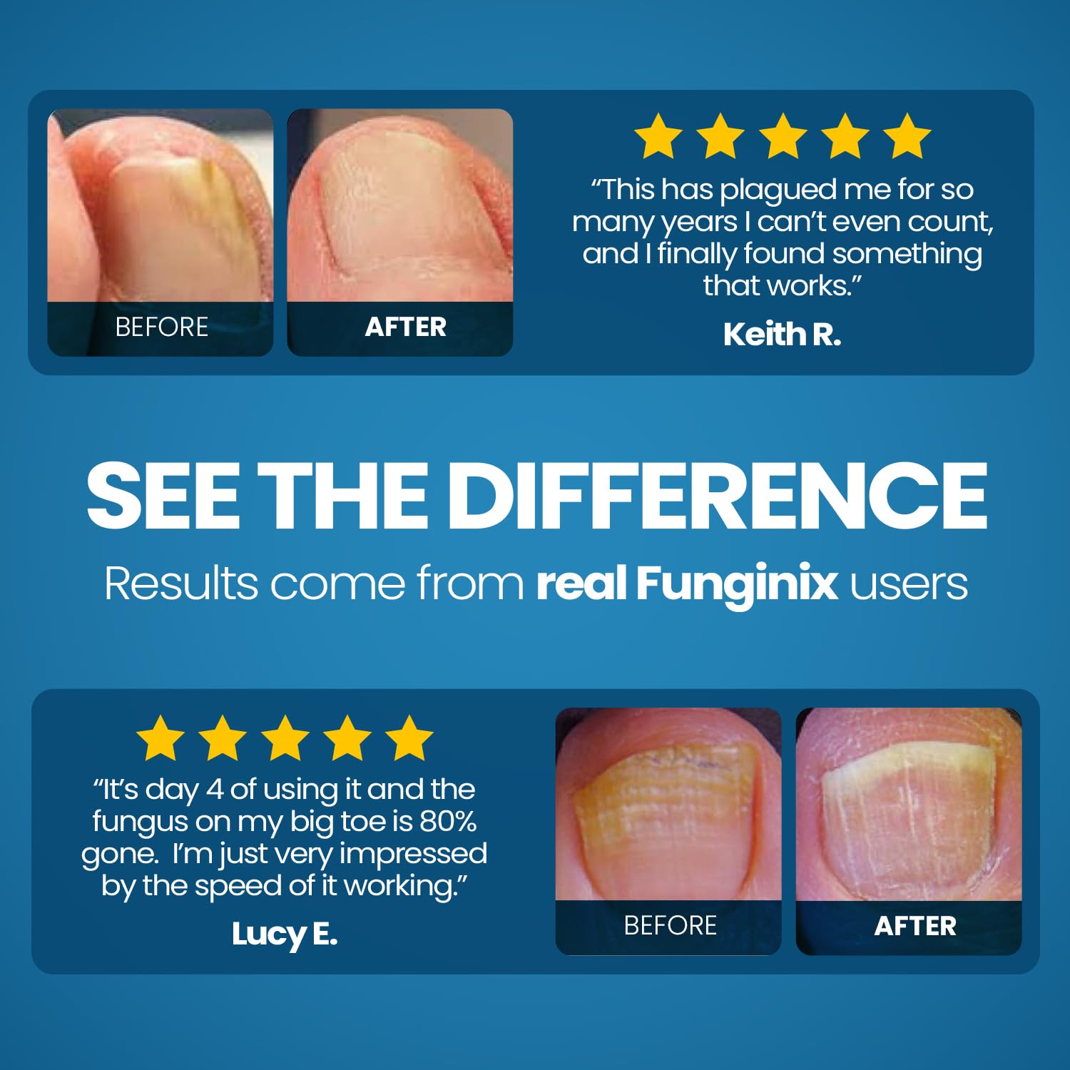 FUNGINIX Toenail Fungus Treatment - Extra Strength - Nail Fungus Treatment & Athlete's Foot Solution - Antifungal Liquid Solution - Made In the USA - 1 Bottle - (Packaging May Vary) - Image 4