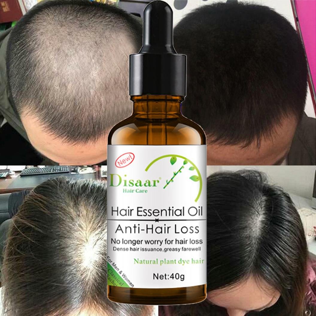Alopecia Hair Loss Treatment Hair Growth Oil Fast Hair Growth