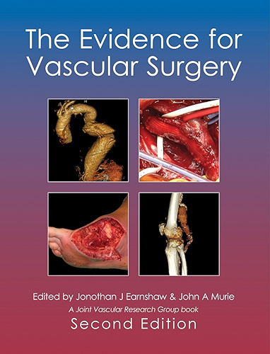 Download The Evidence for Vascular Surgery; second edition (English Edition) PDF