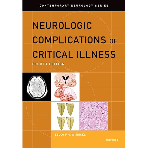 Plum and Posner's Diagnosis and Treatment of Stupor and Coma