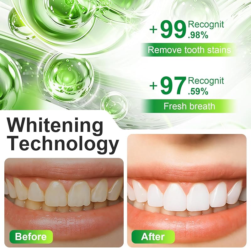 Professionelles Zahnaufhellungsset,10 Whitening-Serum,Zahnbleaching,Effektiv Flecken Entfernen für Weiße Zähne zu Hause,Teeth Aufhellung für ein strahlendes Lächeln,Für Damen und Herren
