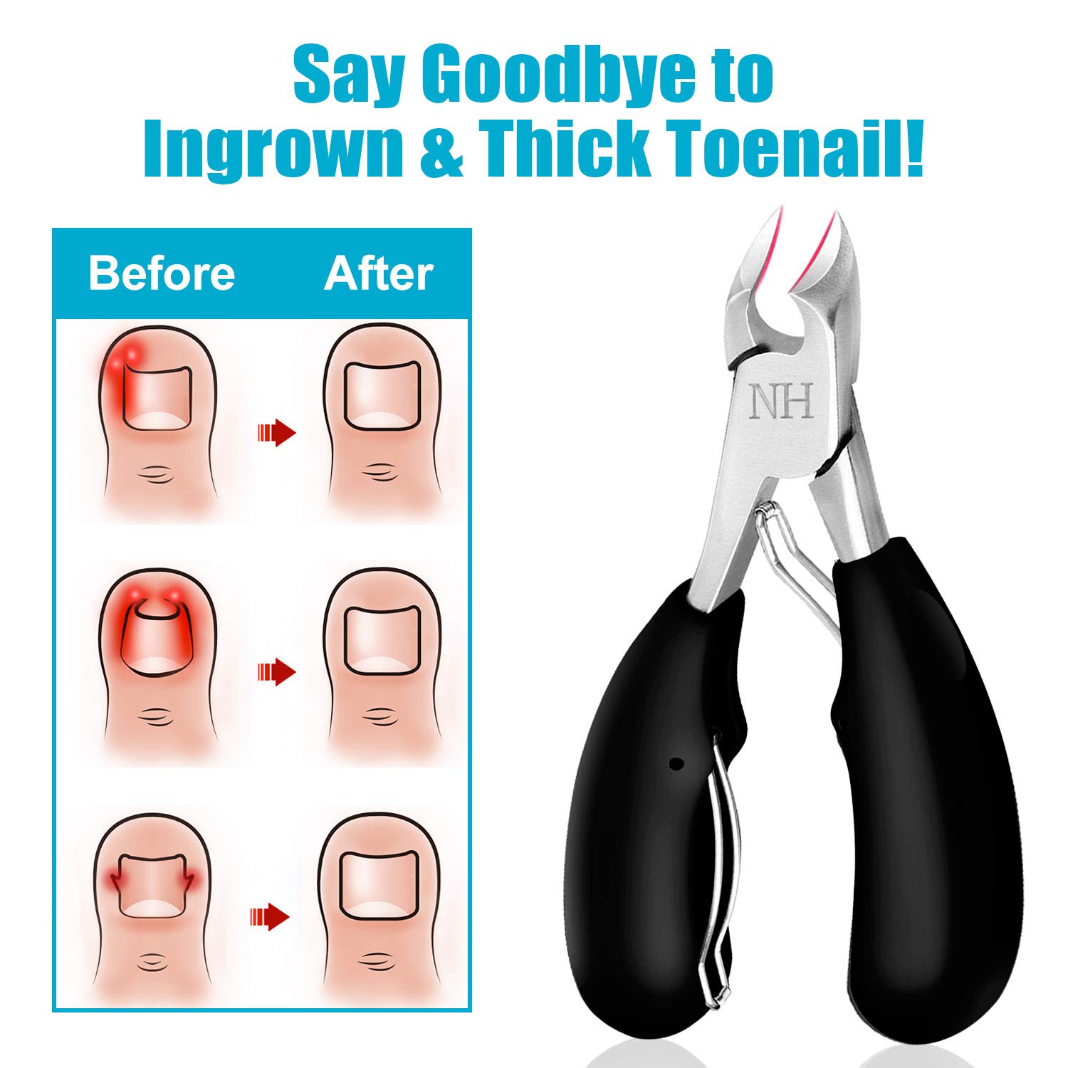Podiatrist Toenail Clippers, Professional Thick & Ingrown Toe Nail Clippers for Men & Seniors, Pedicure Clippers Toenail Cutters, Super Sharp Curved Blade Grooming Tool: Beauty