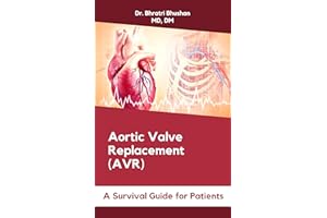 Aortic Valve Replacement (AVR): A Survival Guide for Patients