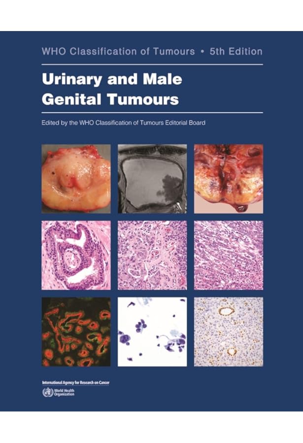 洋書 Breast Tumours , WHO 5th edition Breast Tumours: WHO Classification of Tumours (Medicine