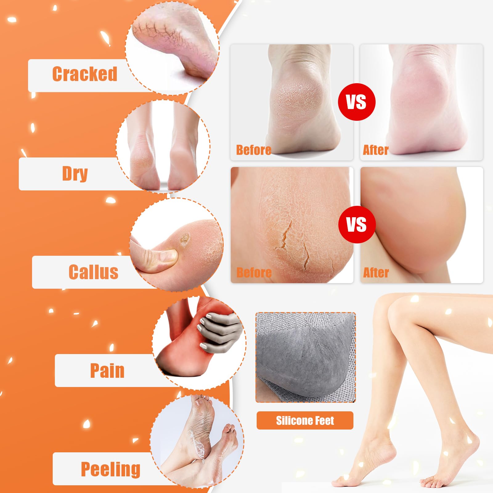 Sagry Sagry 8Pairs Moisturizing Gel Heel Socks, Silicone Heel Socks, Heel Socks for Dry Cracked Feet Women, Toeless Heel Repair Socks for Foot Care Treatment, Cracked Heels, Dry Feet, Foot Calluses