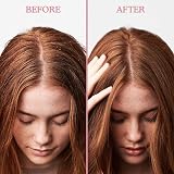 Umberto Giannini Scalp Scrub - Vegan & Cruelty Free Exfoliating Treatment view 3