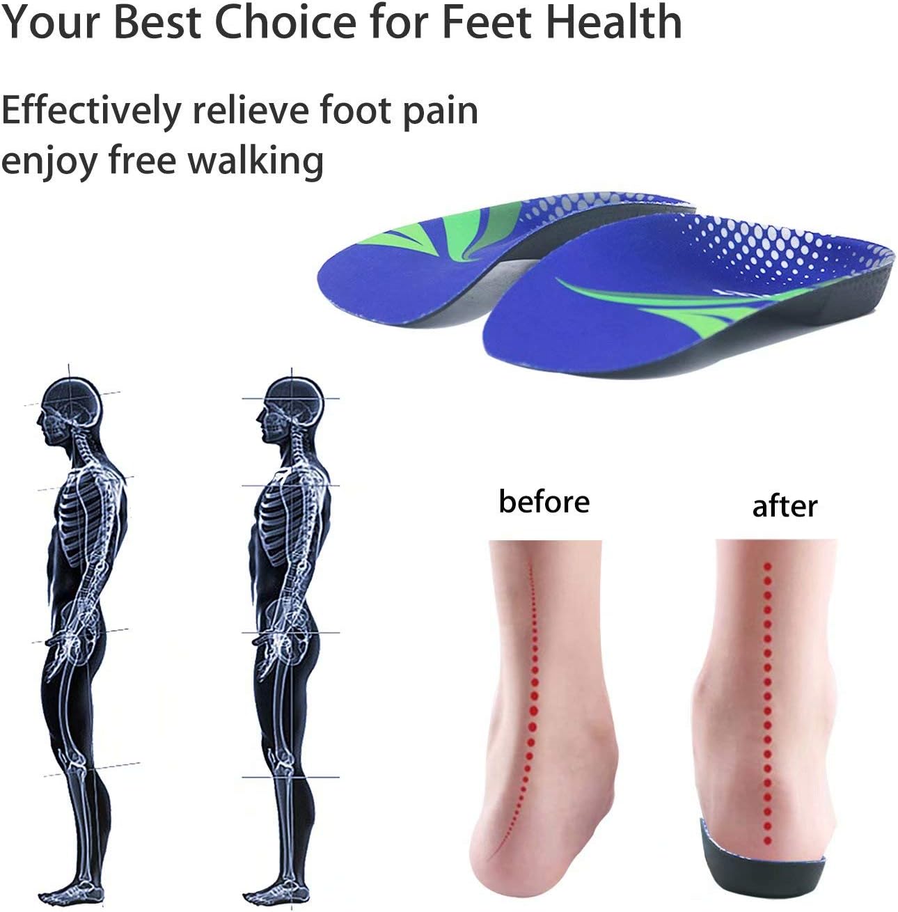 Orthotic Inserts 3/4 Length, High Arch Support Foot Insoles for Over-Pronation Plantar Fasciitis Flat Feet Heel Pain Relief Shoe Inserts for Running Sports Men Women, M|Men's 6.5-8.5, Women's 7.5-9.5: Health & Personal Care