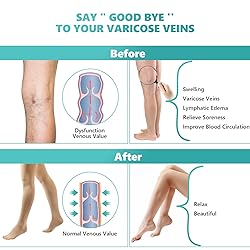 Compression Pantyhose Stockings for Women