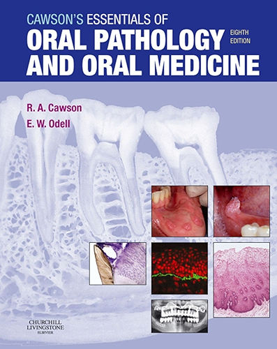 Download Cawson's Essentials of Oral Pathology and Oral Medicine E-Book (English Edition) PDF