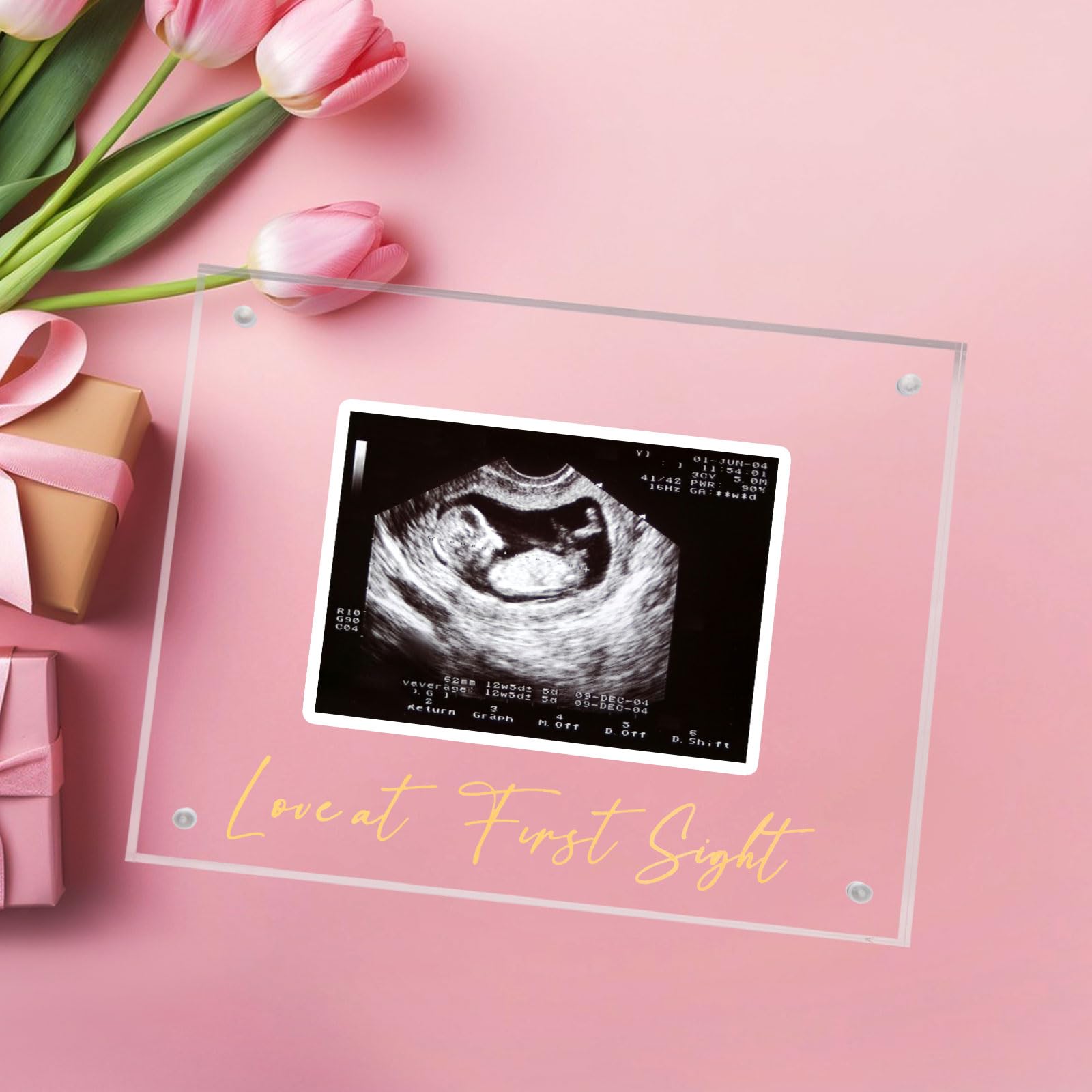 Acrylic Ultrasound Picture Frame, Bright Photo Frame, Sonogram Love at First Sight Baby Keepsake Baby Announcement, Birth Information, Expecting Mom Parents to be Unique Gifts for Pregnant