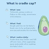 Mustela Cradle Cap Cream 40ml for Baby scalp care 95% natural view 7
