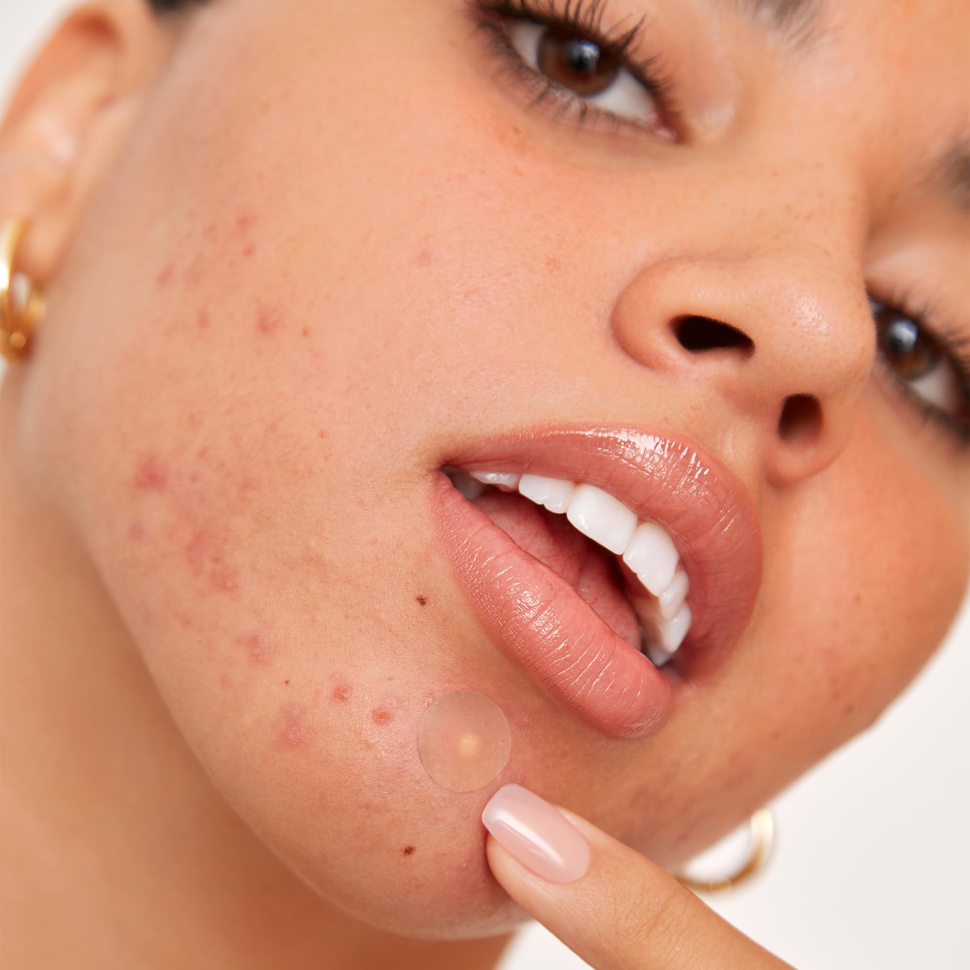PEACE OUT Skincare Acne Dots, Hydrocolloid Pimple Patches Help Clear Blemishes Overnight, Award Winning Fast Acting Anti-Acne Solution (20 dots)