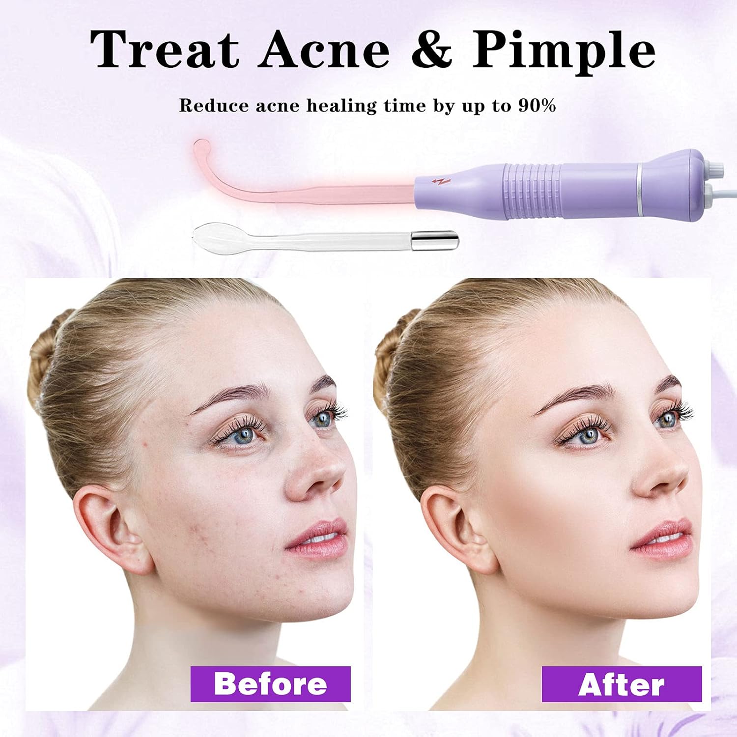Bvcewilty High Frequency Facial Machine Skin - Portable Handheld Skin Therapy Wand for Acne Wrinkles Remover Skin Tightening: Beauty