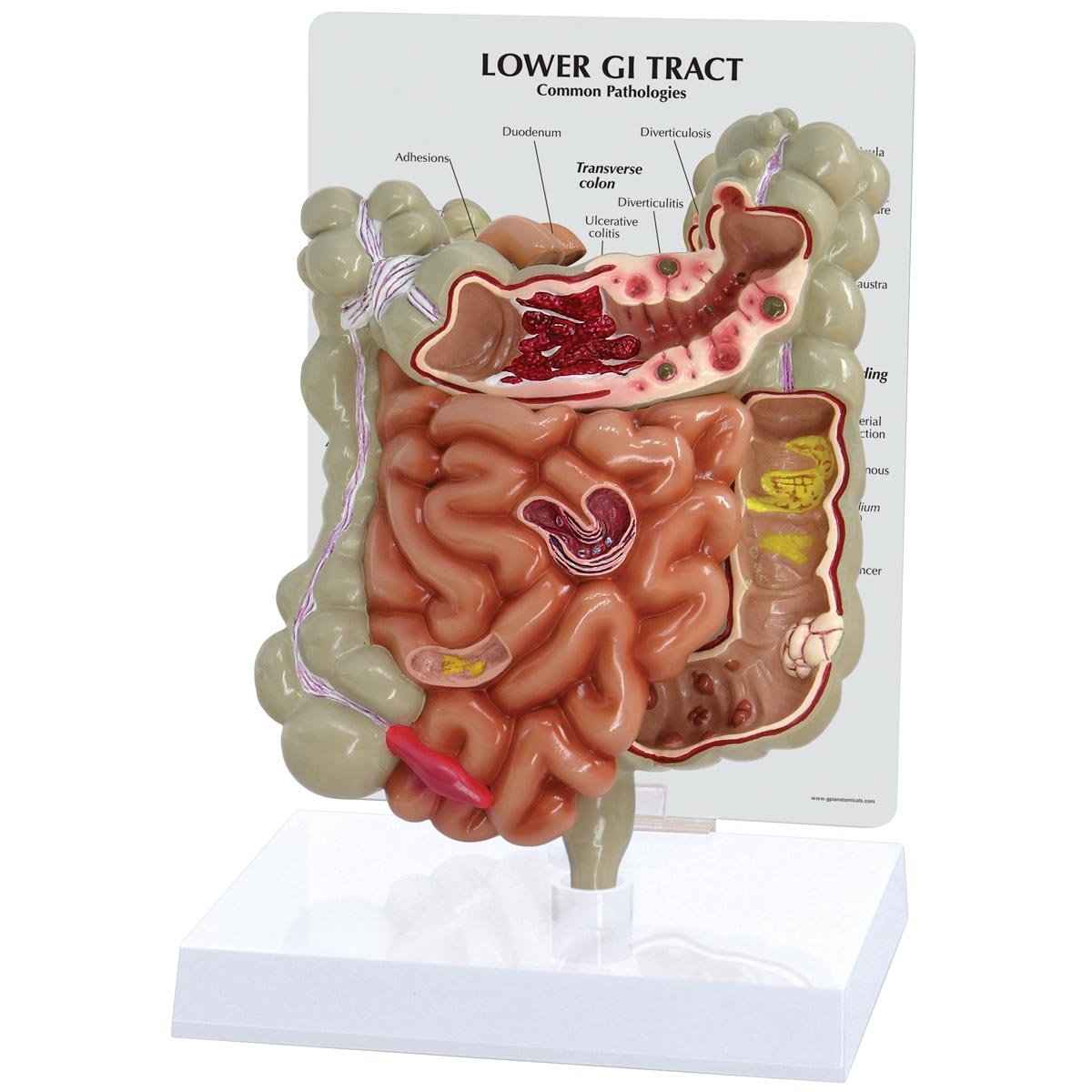 3B Scientific GI Tract Model