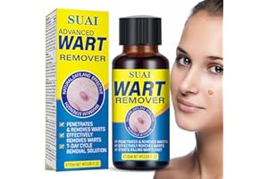 Aimery Fast-Acting Wart Remover, Remover with Salicylic Acid Wart Removal for Women Men, Wart Freeze Off for Plantar Wart,Flat Wart, Common Wart, Corn,H Warts, Callus 20ml