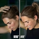 FIXXIE Hairline Powder Root Touch Up Medium Brown with Mirror Puff view 8