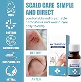 New Skin Liquid Plaster 10ml 2pc Waterproof Breathable Quick-Dry Gel Bandages view 5