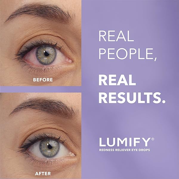 LUMIFY REDNESS RELIEVER EYE DROPS, FOR WHITER & BRIGHTER LOOKING EYES, 0.25 FL OZ (7.5 ML)