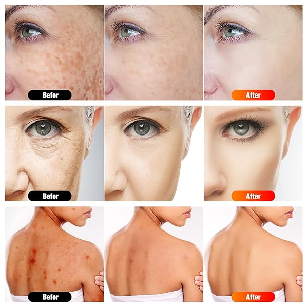 7 IN 1 PORTABLE LIGHT THERAPY FOR FACE FOR BODY LAMP WITH STAND, 920NM RED INFRARED LIGHT THERAPY DEVICE, LED FACE SKIN BODY SKIN CARE AT HOME