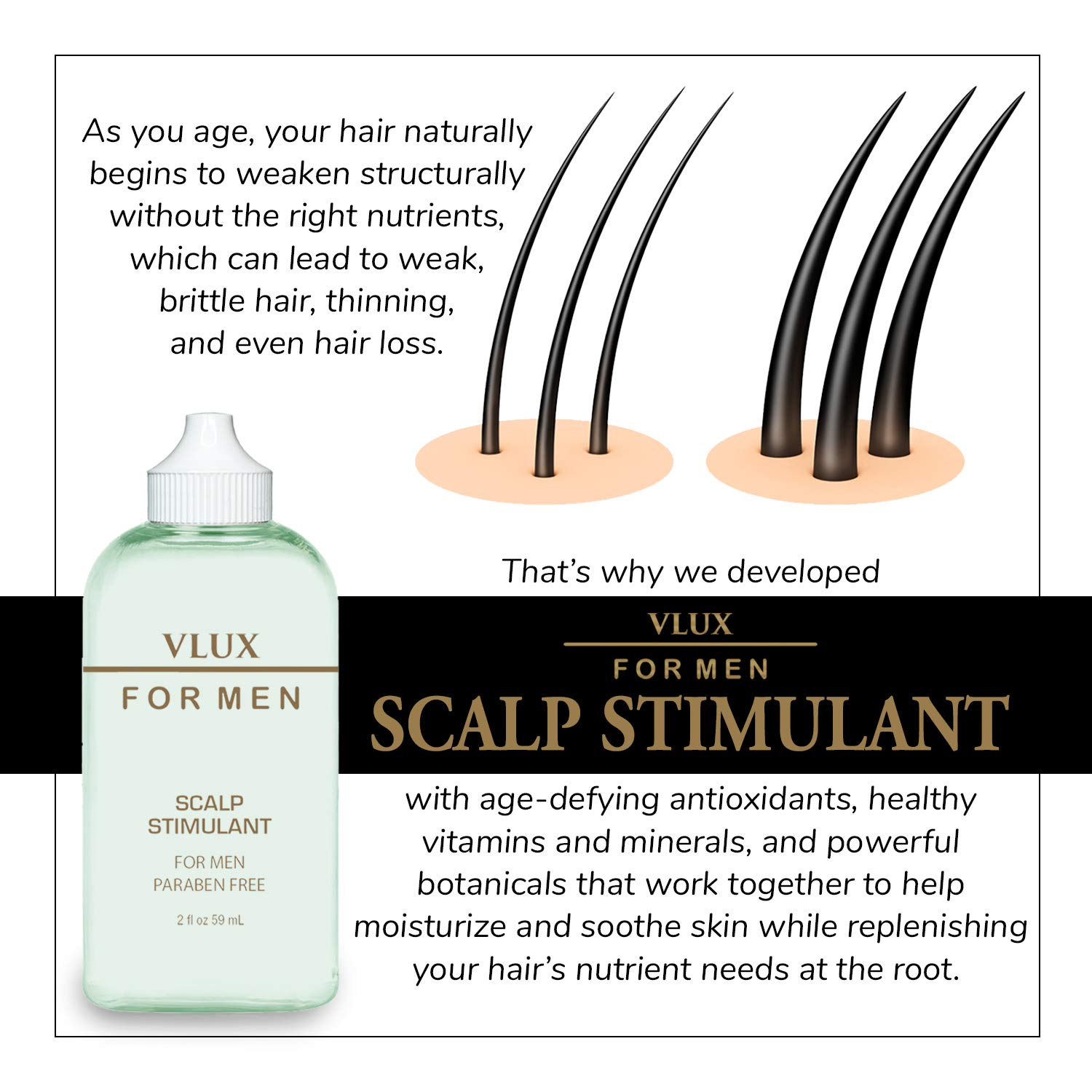 Vlux for Men Scalp Stimulant for Hair Growth, 2 oz, Natural Botanical Extracts Nourish Follicles, Fight Hair Loss, & Condition Skin, Increase Microcirculation for Strong, Healthy Results : Beauty